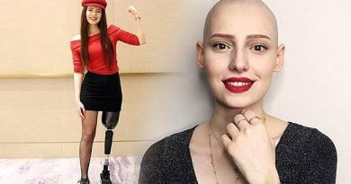 Ще играе ли Неслихан Атагюл момиче с ампутиран крак, починало от рак?